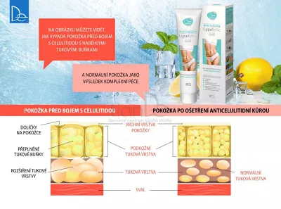 TianDe Lipolytický gél na celulitídu, naplaste wutong, bylinkove vlozky, slaviton mast, tiande naplaste na nadchu, tiande eu