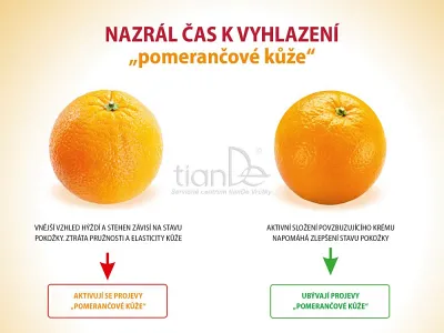 TianDe Povzbudzujúci krém pre dokonalé stehná, tiande recenzie, tiande naplaste, tiande vlozky, tiandebeauty, tiandecentrum