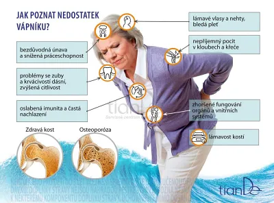 TianDe Calcemarine Complex, tiande eu, tiande foot phytogelslaviton gel, naplaste wutong, bylinkove vlozky, slaviton mast