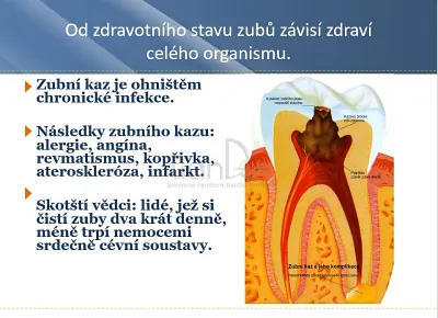 TianDe Zubný gél Prírodná bambusová soľ, bylinkove vlozky, slaviton mast, tiande naplaste na nadchu, tiande eu, tiande foot phytogelslaviton gel